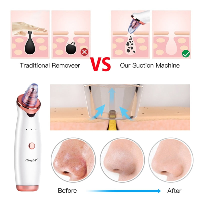 Electric Blackhead Remover Facial Cleansing Pore Pimples