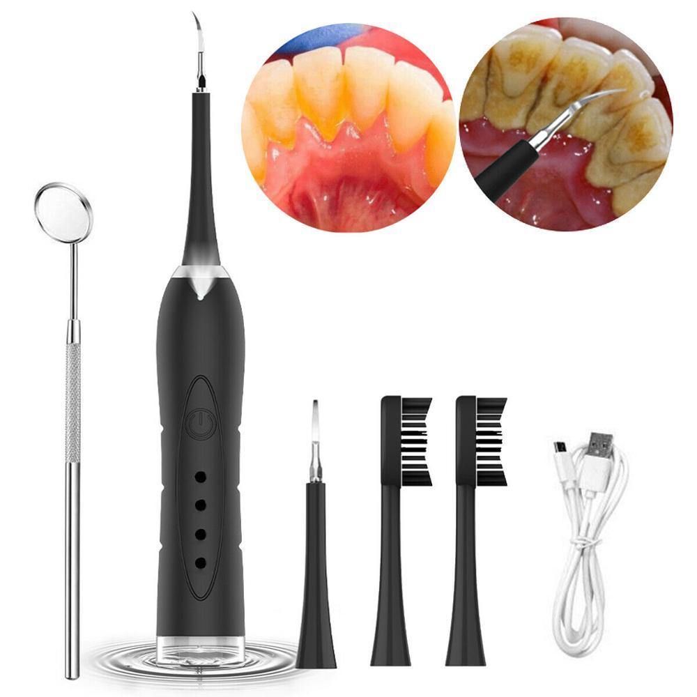 Electric Portable Sonic Dental Scaler Tooth Calculus Remover Tooth Stains Tartar Tool Dentist Whiten Teeth Health Hygiene white