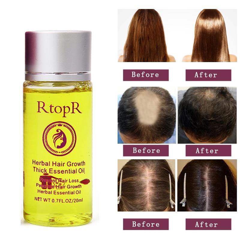 Women Men Herbal Hair Growth Essence Anti Hair Loss Liquid Promote Thick Fast Hair Growth Treatment Essential Oil Health Care